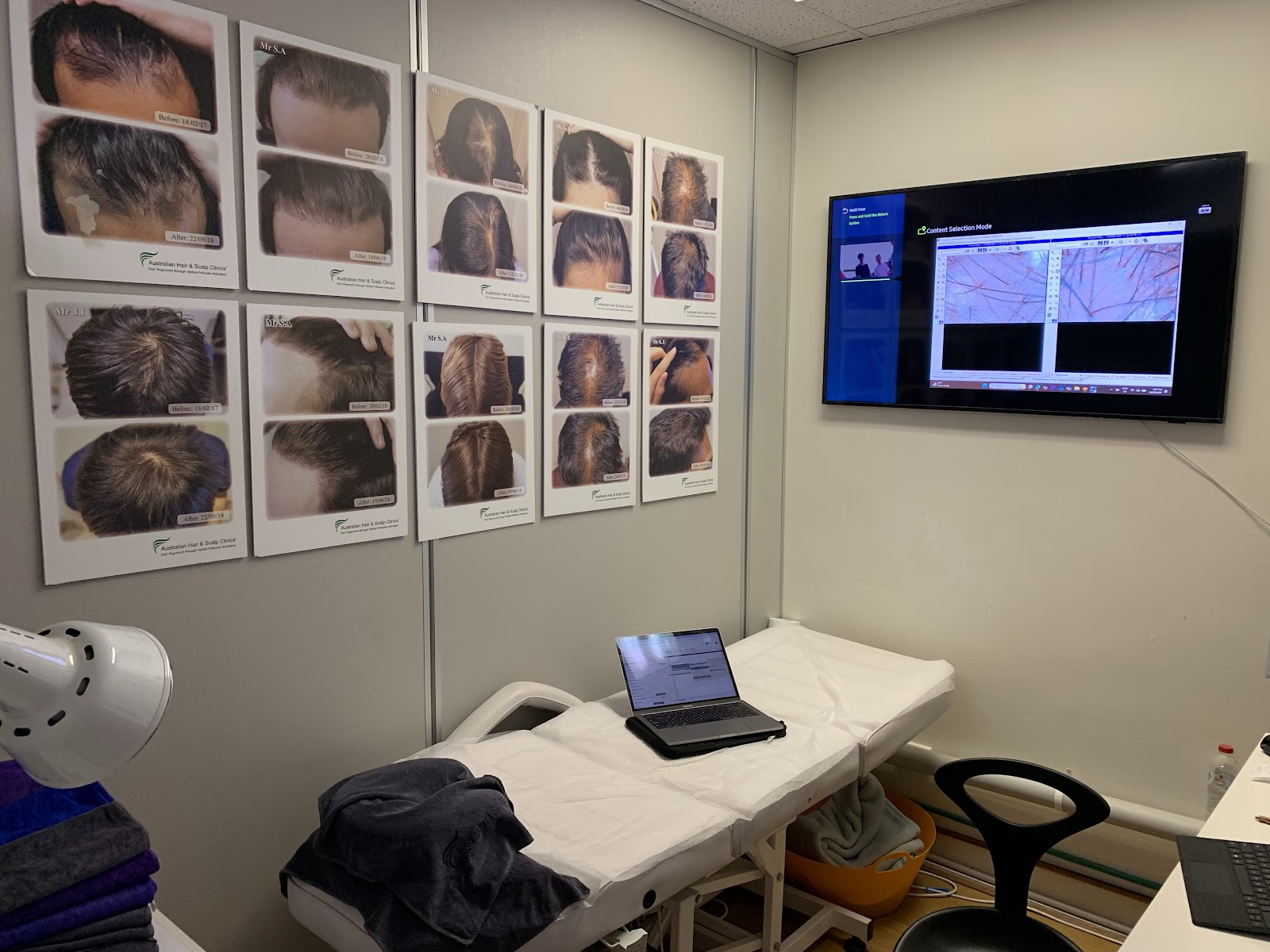 Australian Hair & Scalp Clinic, Doncaster East, VIC